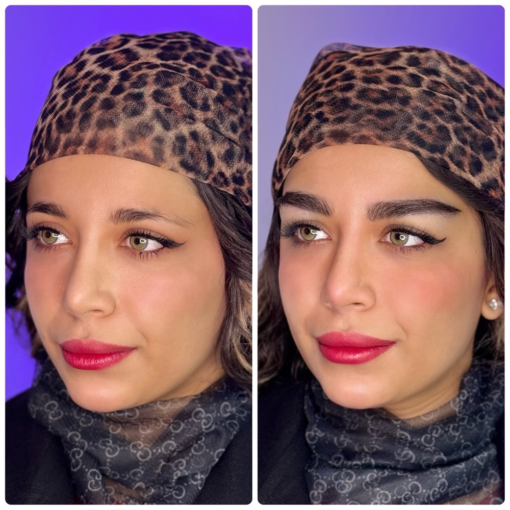 کاشت ابرو