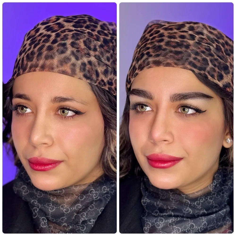 کاشت ابرو