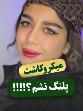 رضایت کاشت